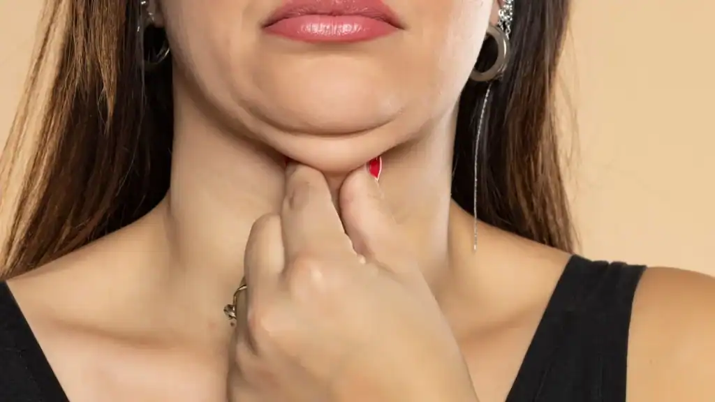 An image of a woman with double chin, sad, worried : Non Surgical Double Chin Removal Treatment in Westcliff on Sea, UK