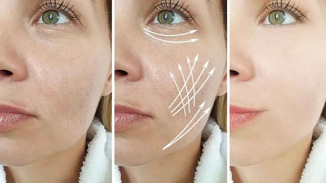 Can One Treatment Really Tackle More Than One Skin Concern Westcliff on Sea?
