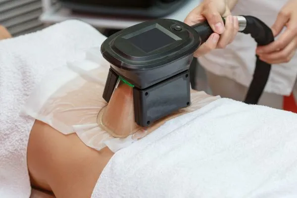 Image of person having fat freezing treatment to help weight gain Westcliff on Sea