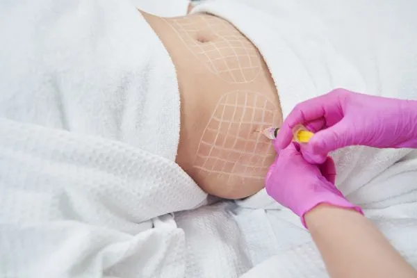 image of fat dissolving injections on love handles to help combat weight gain Westcliff on Sea
