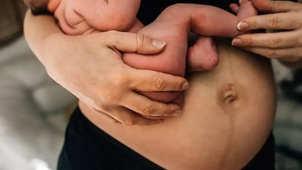 Why Is My Stomach Still Big After Pregnancy Westcliff on Sea?